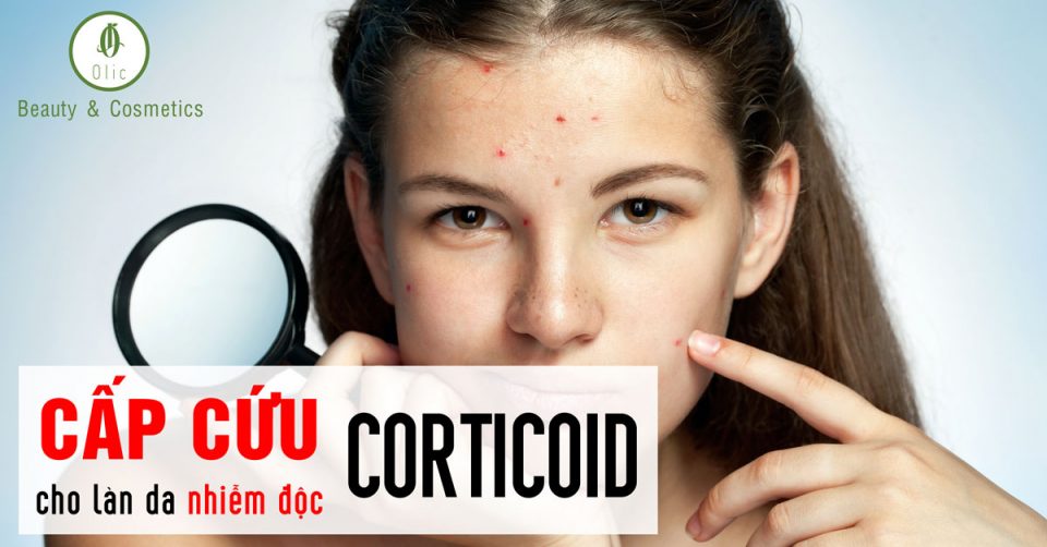 Cấp cứu cho làn da nhiễm độc corticoid