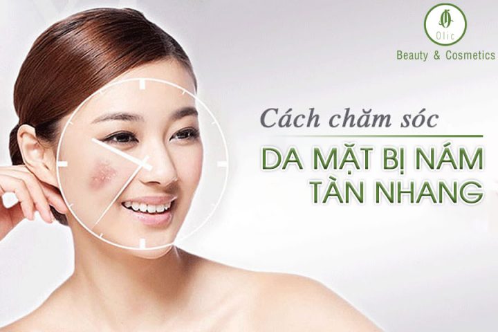 cách chăm sóc da mặt bị nám, tàn nhang hiệu quả
