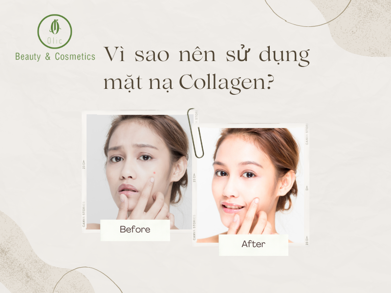 Vì sao cần sử dụng mặt nạ collagen?