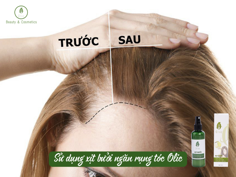 Sử dụng xịt bưởi ngăn rụng tóc Olic